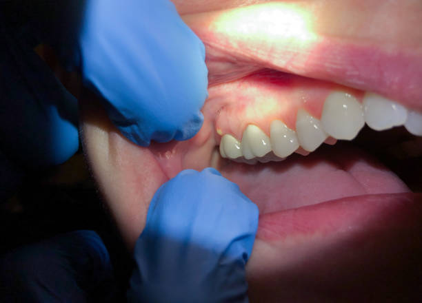 Best After-Hours Dental Trauma Care in East Brooklyn, CT