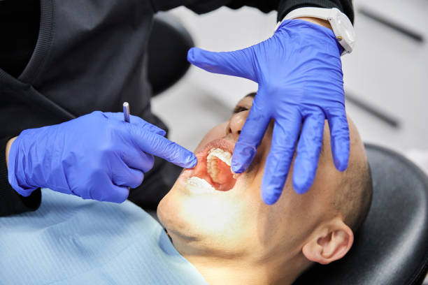 Best Emergency Treatment for Dental Infections or Abscesses in East Brooklyn, CT