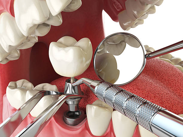 Best Cosmetic Emergency Dentistry in East Brooklyn, CT